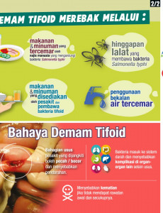 Demam Tifoid 02